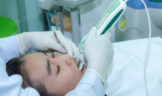 Sử dụng hệ thống thẩm định - phân tích khớp cắn T-scan kiểm tra khớp cắn