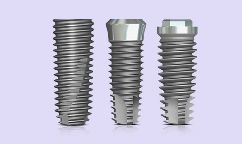 Implant Hàn Quốc có chất lượng tốt với mức giá phải chăng