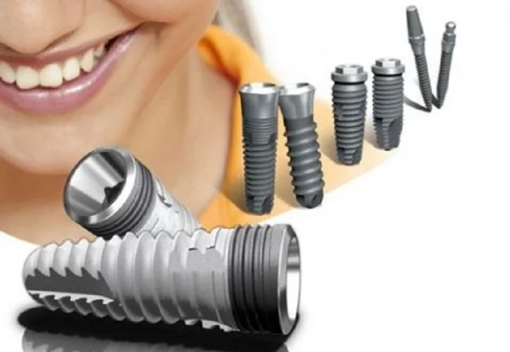Trụ Implant Hàn Quốc đa dạng về chủng loại
