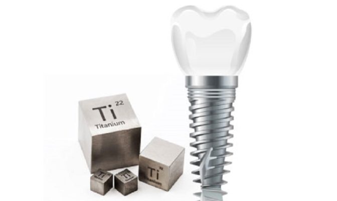 Trụ Implant được chế tác từ Titanium nên có độ bền chắc rất cao