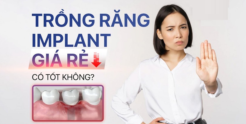Cấy ghép Implant tại cơ sở giá rẻ có nên không?