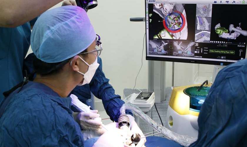 Tại Implant Center kỹ thuật Implant xương gò má được thực hiện trên thiết bị hiện đại