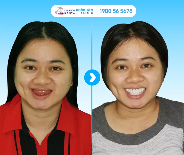 Khách hàng Implant Center