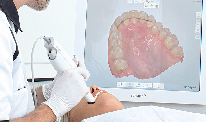 Chỉ trong 2 phút thực hiện, scan 3D sẽ cho hình ảnh toàn bộ cung hàm của khách hàng