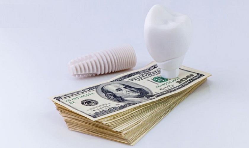 Trồng răng giả vĩnh viễn giá bao nhiêu tại Implant Center năm 2023?