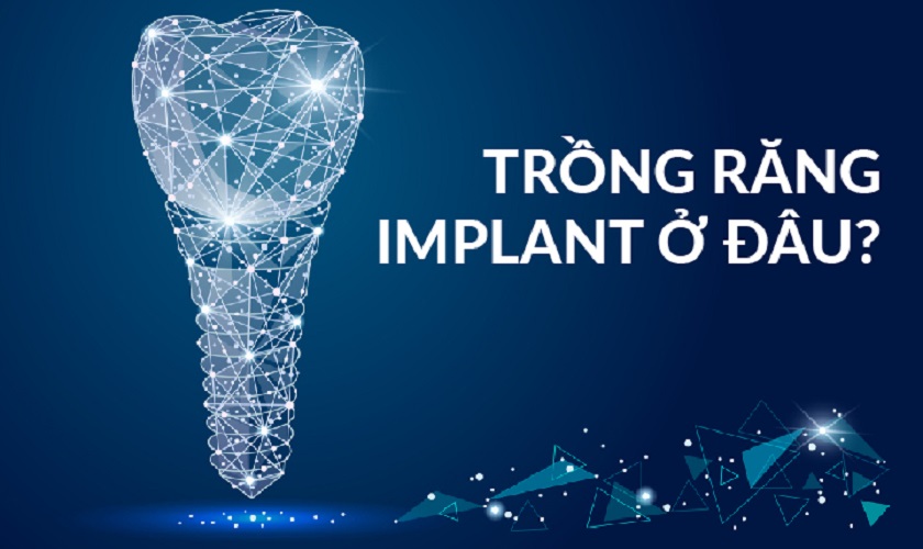 Trồng răng Implant tại Tp.hcm