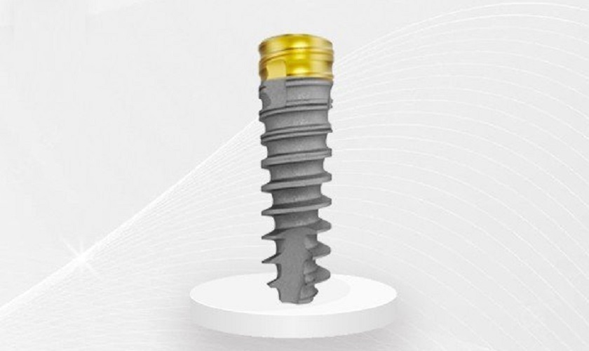 Trụ Implant Nobel TiUltra – Nguồn gốc, đặc điểm và giá thành