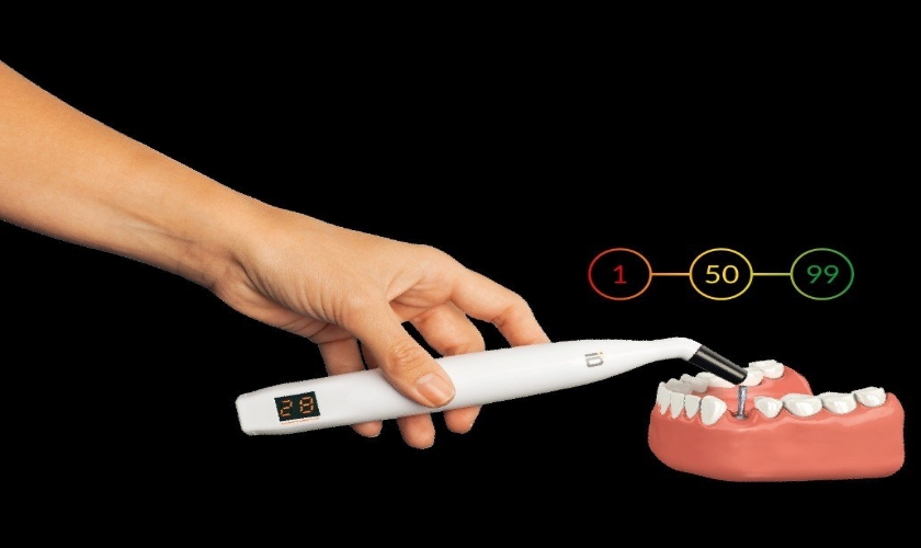 Sự tiện ích của PenguinRFA thiết bị đánh giá độ ổn định của Implant