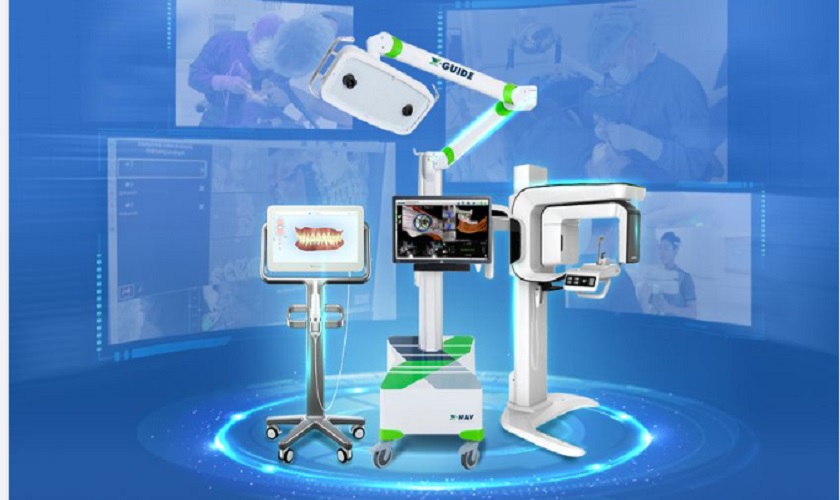 Cấy ghép Implant All on X với công nghệ định vị X-Guide