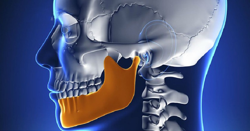 Khách hàng cần có cấu trúc xương hàm cứng chắc để trồng răng Implant