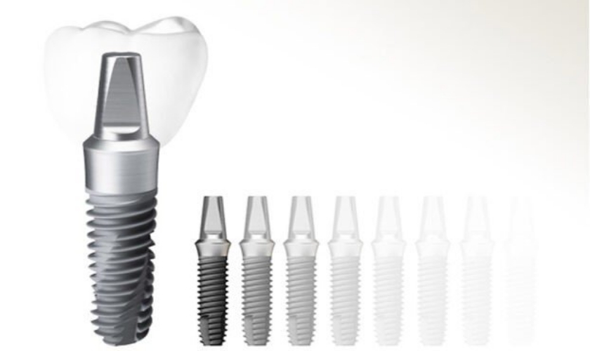 Implant Hiossen dòng trụ được nhiều khách hàng tin dùng