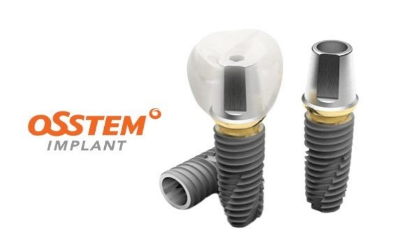 Implant Osstem bảo hành lên đến 20 năm