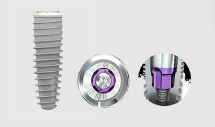 Implant SIC và những điều cần biết