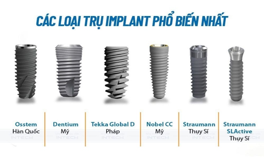 Một số loại trụ implant được sử dụng phổ biến nhất hiện nay