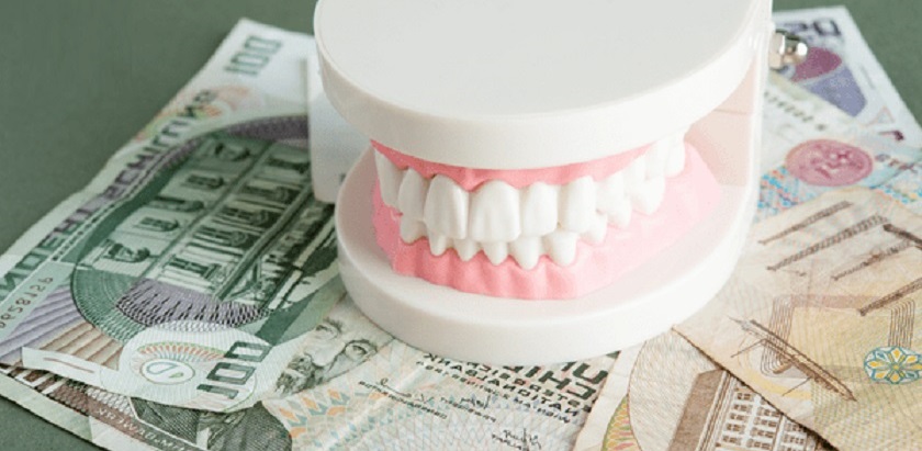 Chi phí trồng răng Implant All on 4 ở mức tương đối cao