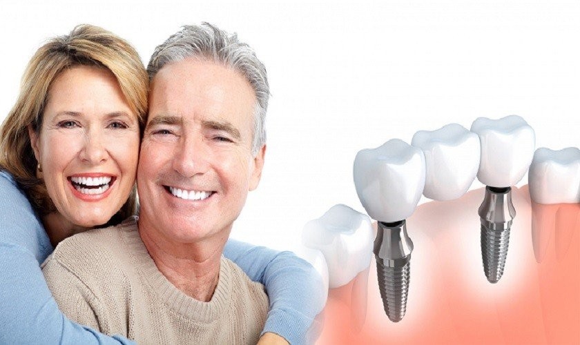 Trồng răng implant có biến chứng không? Giải pháp khắc phục tốt nhất