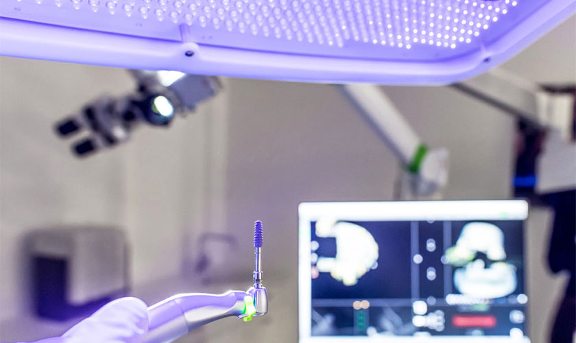 Trồng răng Implant công nghệ mới – An toàn, nhanh chóng, chính xác