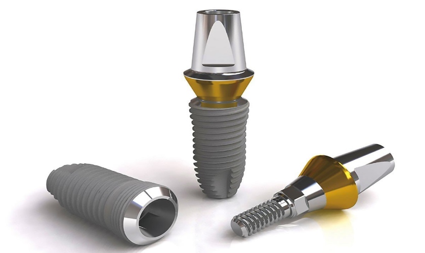 Trụ Implant Nobel TiUltra loại trụ có mặt trên hơn 80 quốc gia