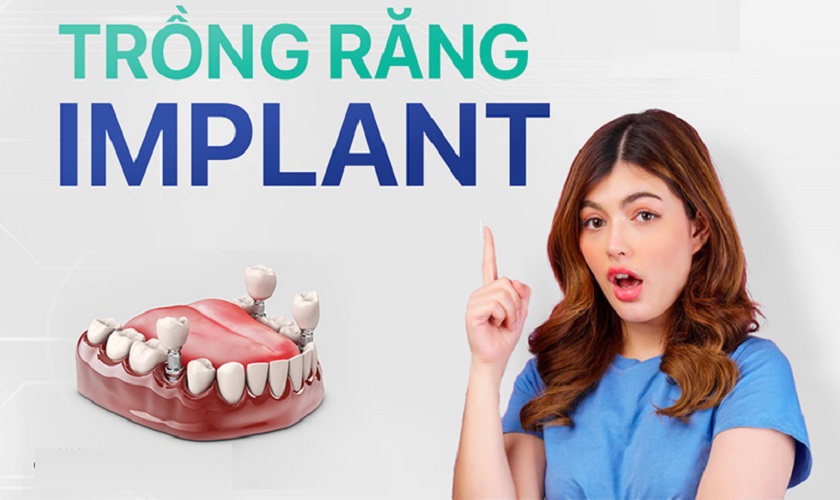 Trồng răng Implant tại Implant Center