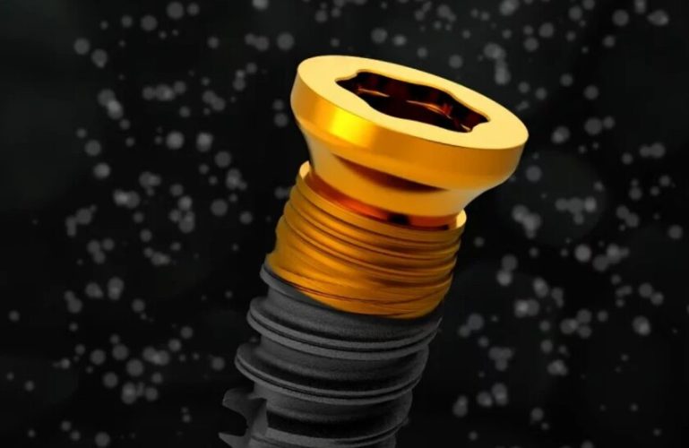 Trụ Implant Nobel TiUltra ưu điểm vượt trội hơn so với các loại trụ implant khác