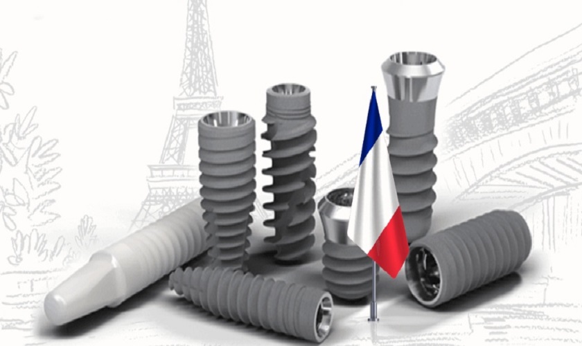 Tìm hiểu về trụ Implant Pháp: Chất lượng và giá thành