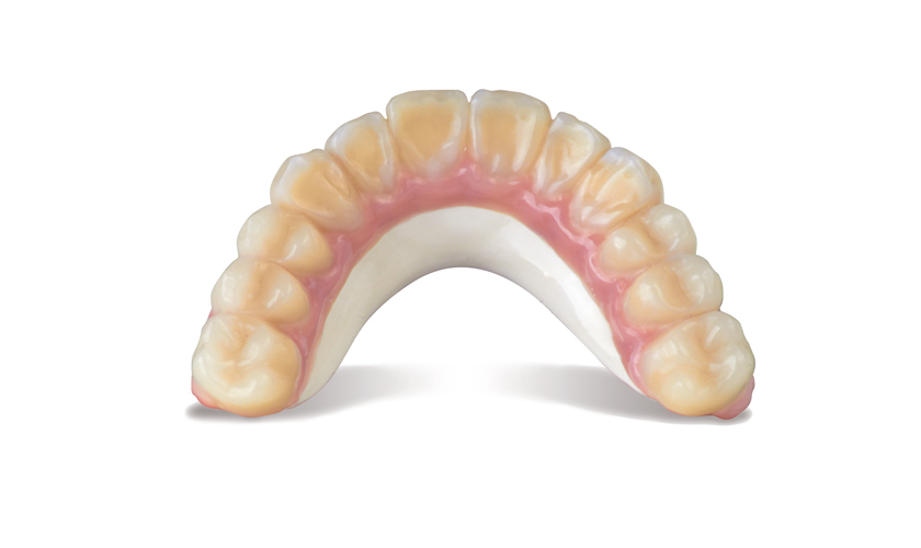 BioHPP vật liệu mới trong phục hình Implant hiện đại có độ bền cao