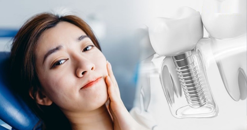 Cấy ghép Implant có bị sưng mặt không?