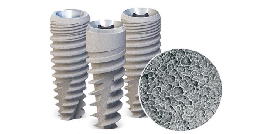Trụ Implant Mỹ được sản xuất với công nghệ xử lý bề mặt siêu sạch