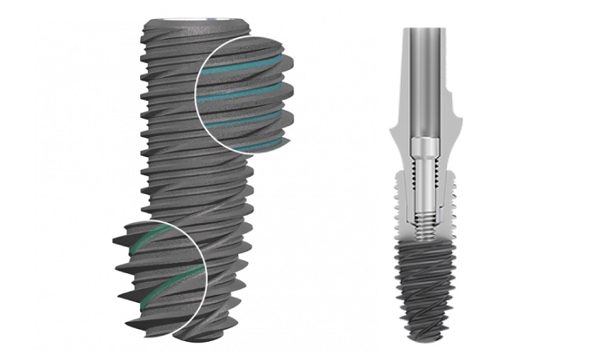 Bề mặt trụ Implant Pháp được xử lý bằng công nghệ hiện đại