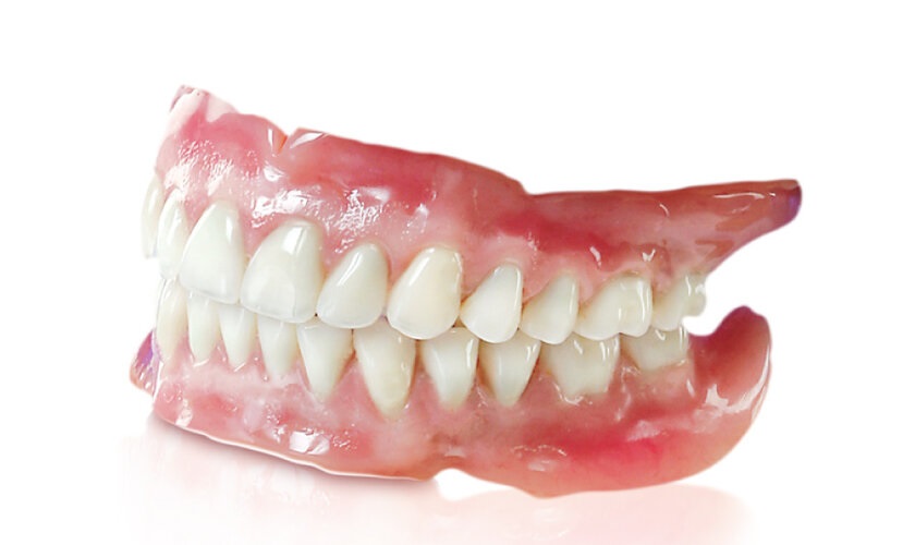 Có nên thay hàm tháo lắp bằng trồng răng Implant không