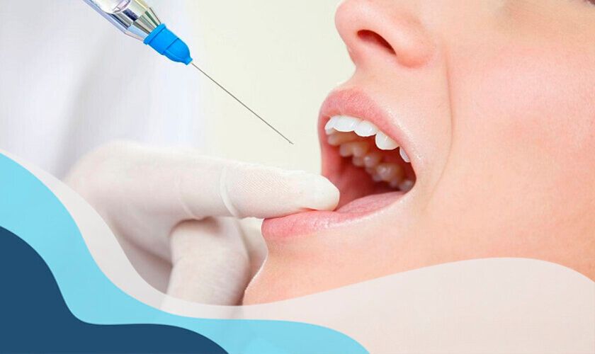 Gây mê trong cấy ghép Implant có cần thiết không?
