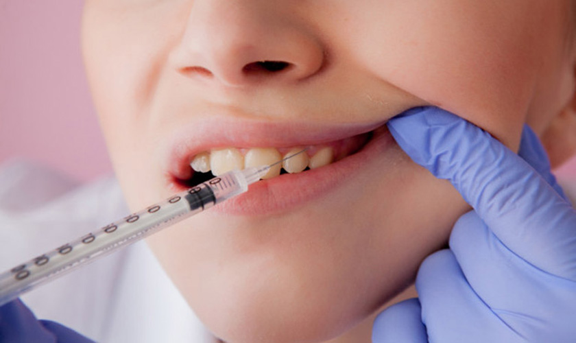 Có cần gây tê trong cấy ghép Implant không?