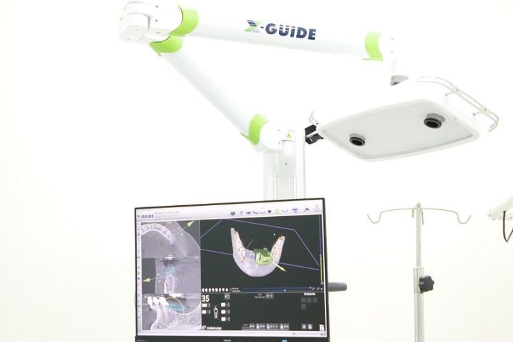 Giám sát bằng thị giác của công nghệ định vị X-guide