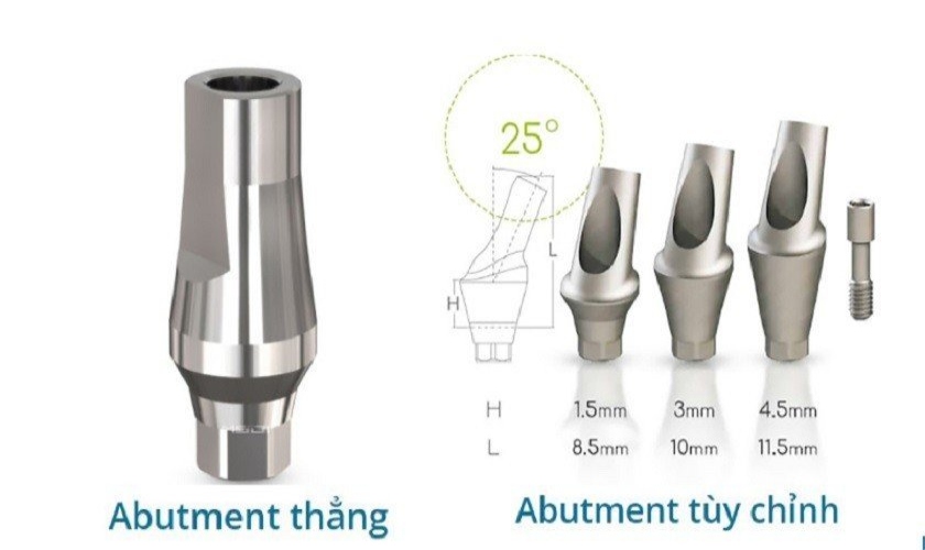 Phân loại Healing Abutment theo hình dạng