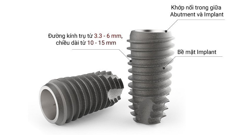 Trụ Implant Hàn Quốc với thiết kế thông minh