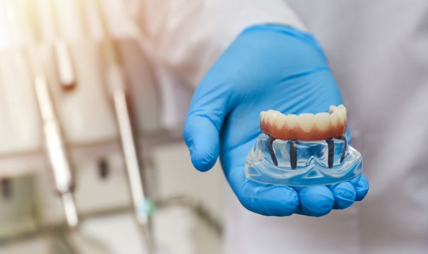 Mắc bệnh lý y khoa có được cấy ghép Implant không?