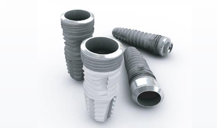 Trụ Implant Hàn Quốc