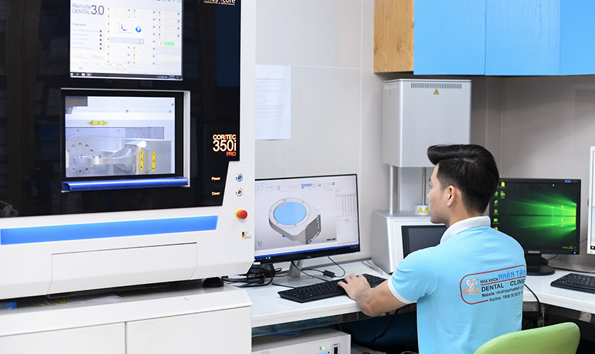 Implant Center sở hữu hệ thống Labo chế tác răng sứ ngay tại nha khoa