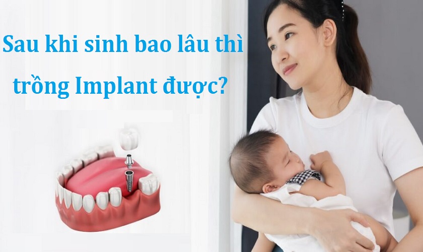 Sau khi sinh bao lâu thì trồng răng Implant được?