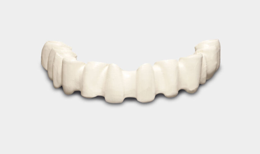 BioHPP là một vật liệu mới có thể sử dụng trong trồng răng Implant