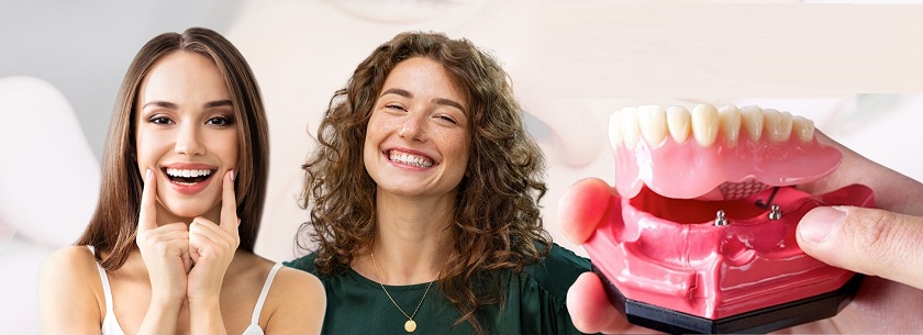 Hàm tháo lắp trên Implant mang lại thẩm mỹ tự nhiên cho người dùng