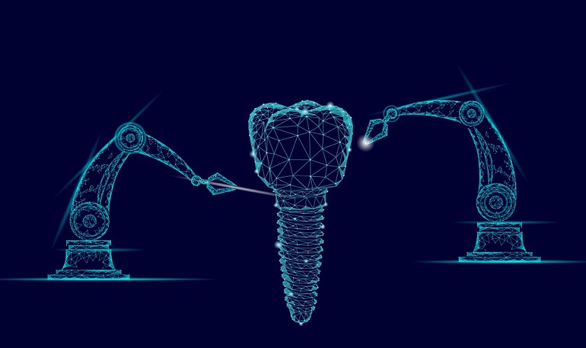 Cấy ghép Implant kỹ thuật số tại Implant Center