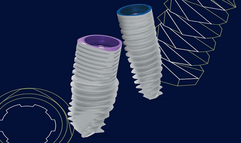 Top 5 thương hiệu Implant phổ biến tại Việt Nam