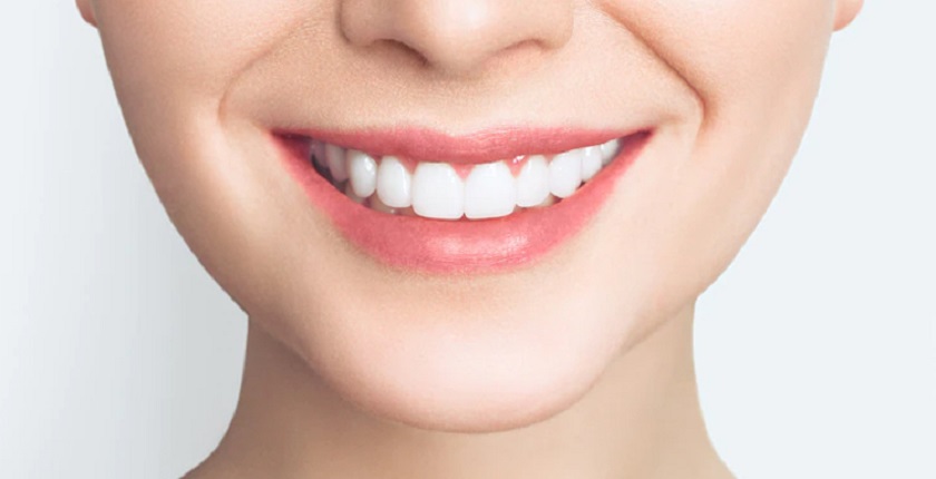 Trồng răng trả góp giúp bạn nhanh chóng có hàm răng mới khỏe đẹp mà không cần lo lắng quá nhiều về tài chính