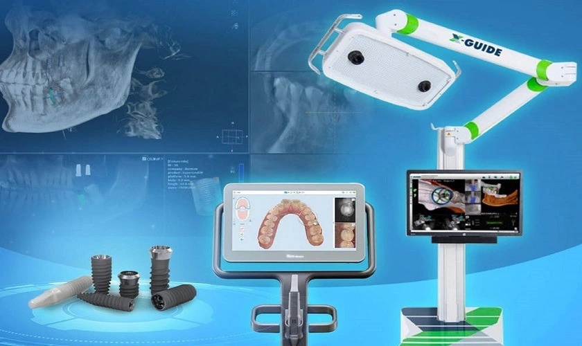 Khám phá ngay giá trồng răng sứ Implant chi tiết nhất 2023 34 Máng hướng dẫn phẫu thuật sử dụng công nghệ định vị cấy ghép Implant