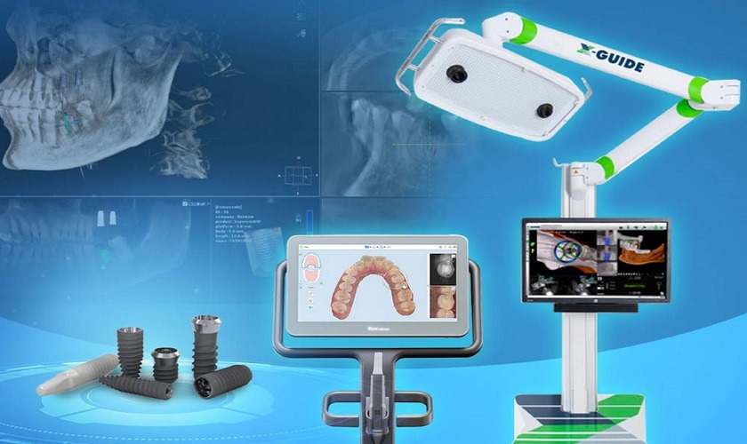 Công nghệ trồng răng Implant tại Implant Center