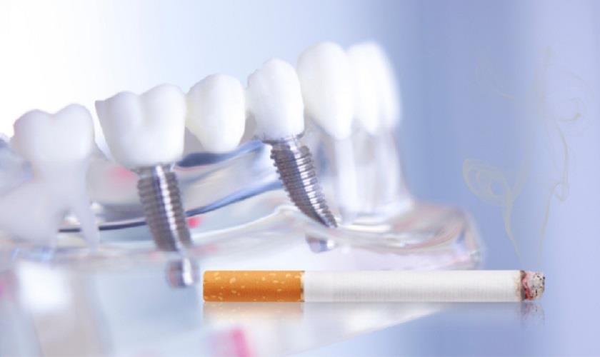 Sử dụng chất kích thích làm tăng nguy cơ nhiễm trùng Implant
