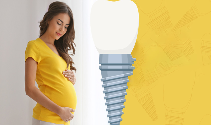Phụ nữ mang thai có trồng Implant được không?