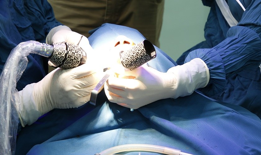 Cấy ghép Implant mất bao lâu?