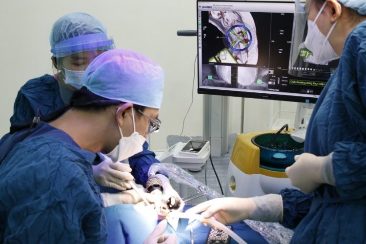 Implant xương gò má cần được chỉ định và thực hiện bởi bác sĩ nha khoa chuyên sâu về Implant